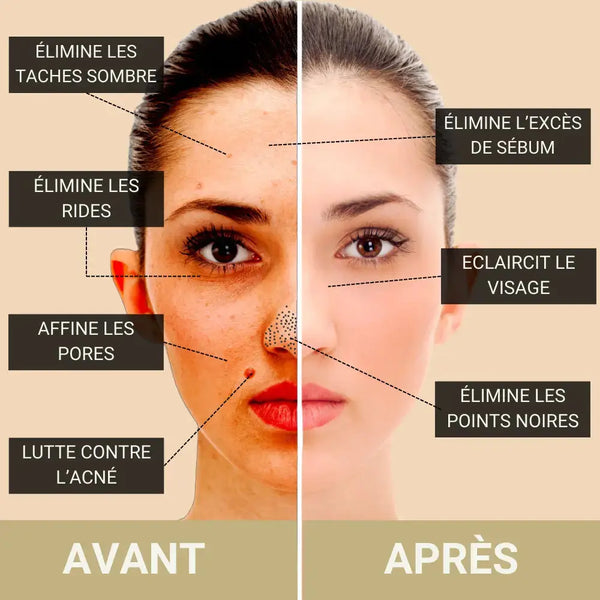 Crème visage bave d'escargot 92 %